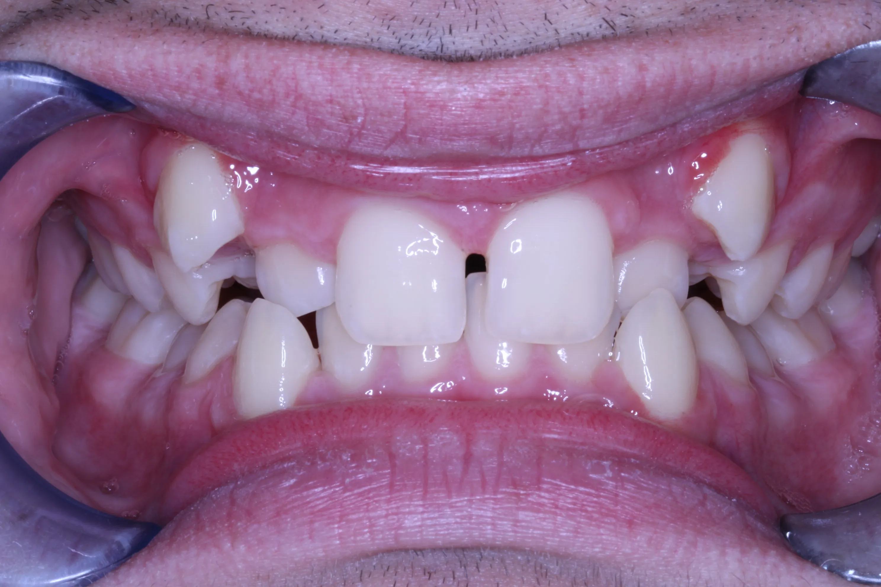 smile-gallery gallery